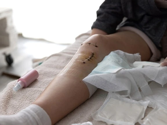 rehabilitacja_acl_2